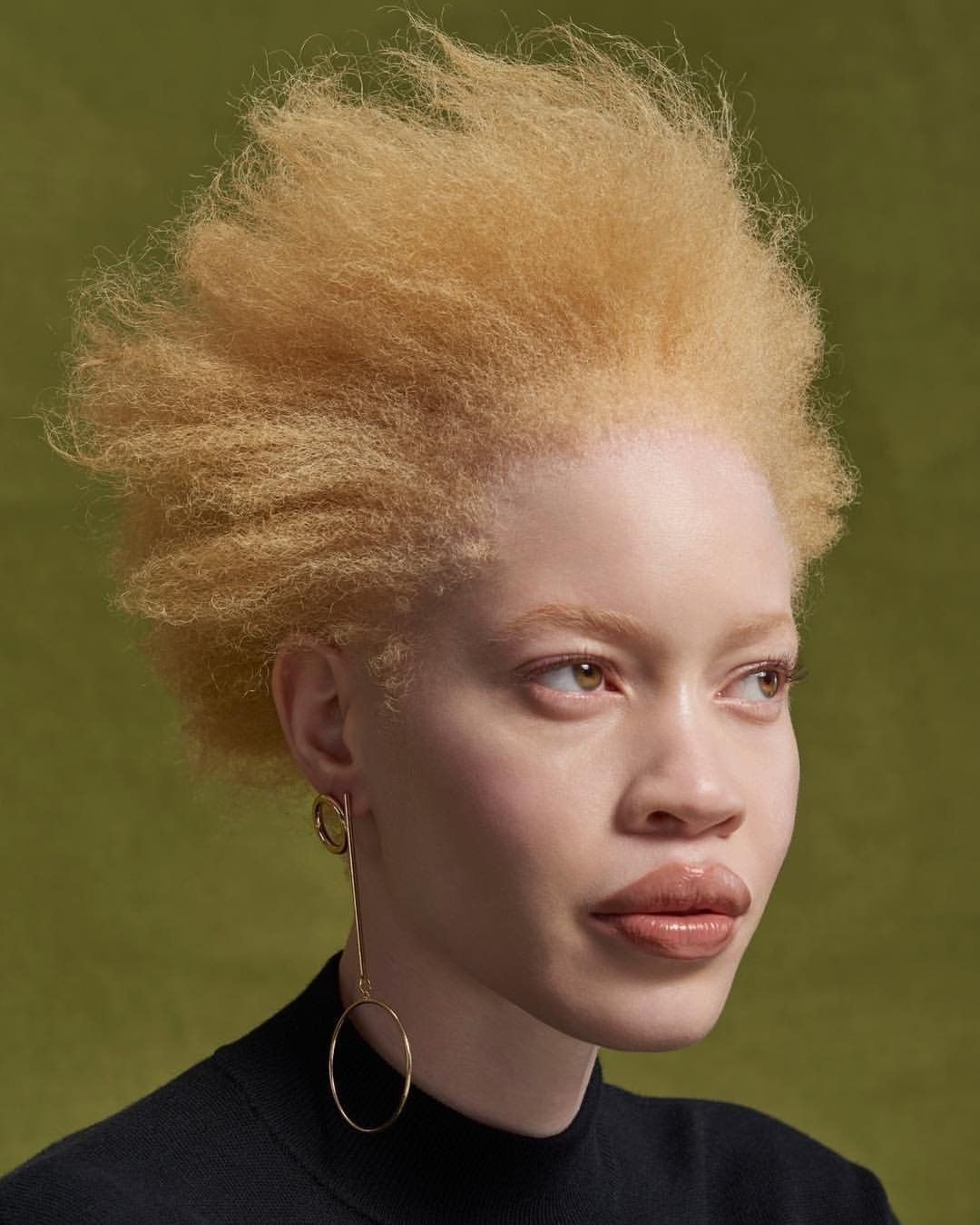 альбинос негроидной расы. джуэлл джеффри альбинос. чернокожий альбинос. лео джона. чернокожий альбинос.