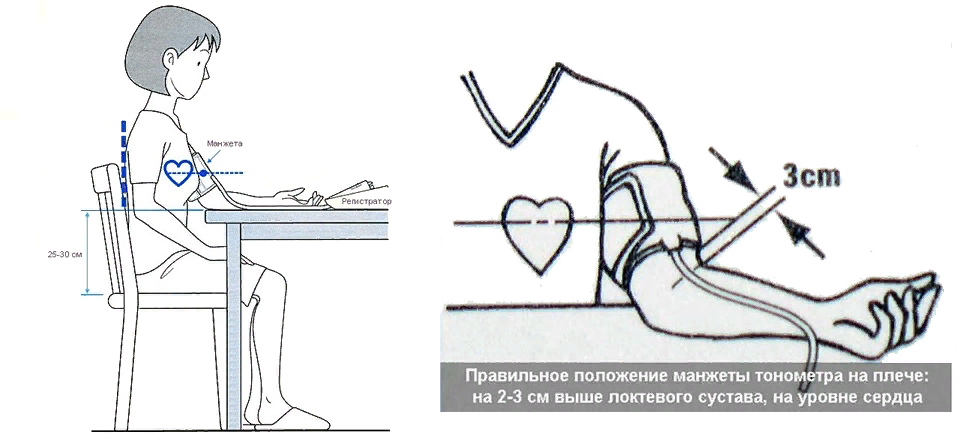 Как правильно измерять давление автоматическим тонометром. Положение руки при измерении артериального давления. Как правильно надеть манжету для измерения давления. Положение манжеты при измерении ад. При измерении артериального давления манжета накладывается на.
