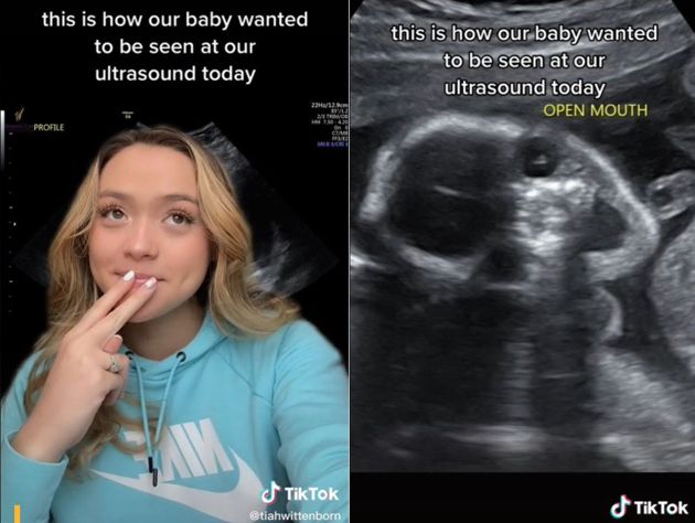 Страшно весело: улыбающийся эмбрион набрал десять миллионов просмотров
