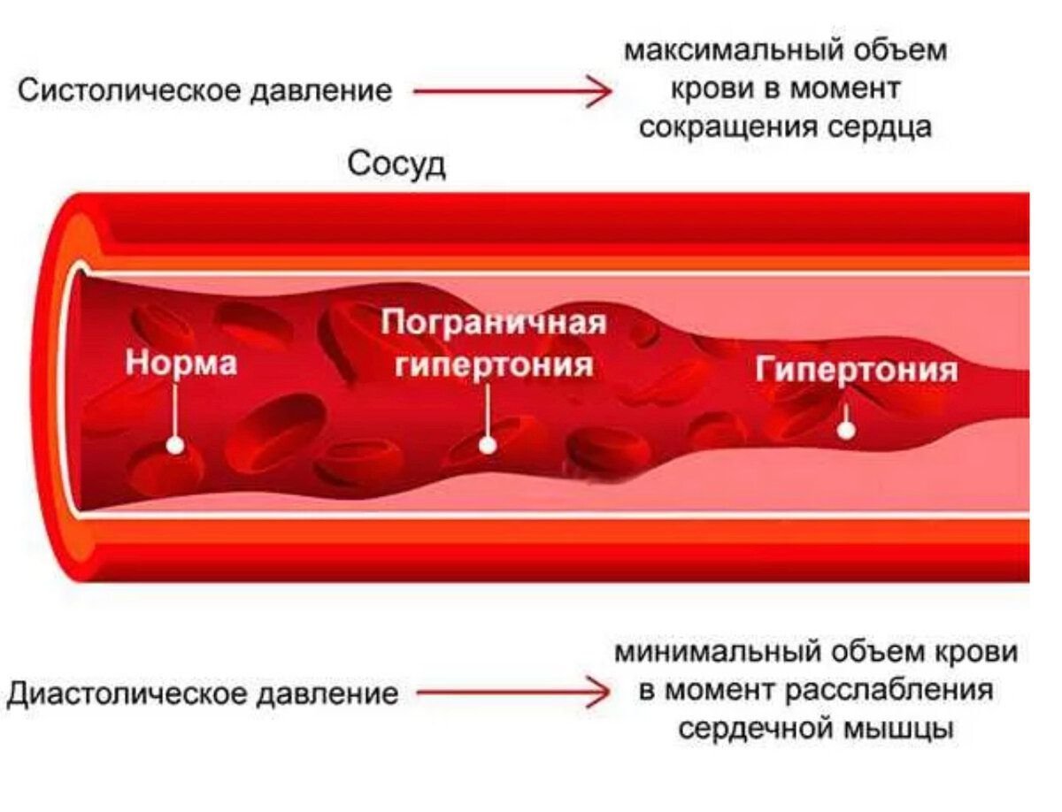 Почему сужаются сосуды