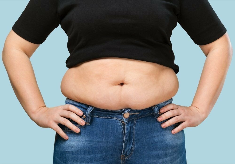 Живот толстухи. Лишний вес. Избыточный вес. Лишний вес у женщин.
