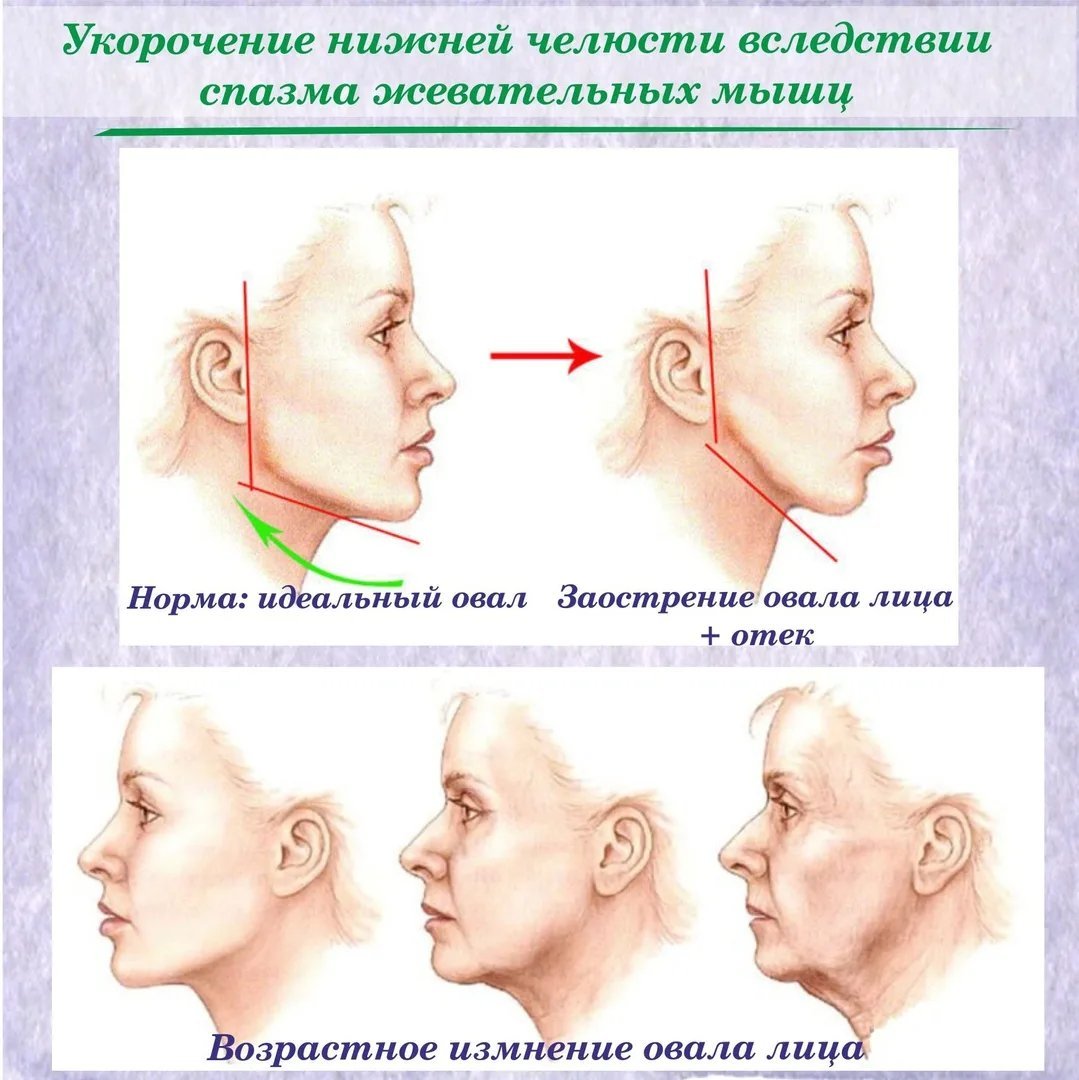 Угол молодости и жевательные мышцы