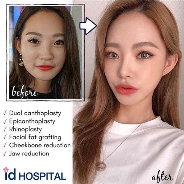 Стандарты корейской красоты по фото. REALSELF korean Contouring.