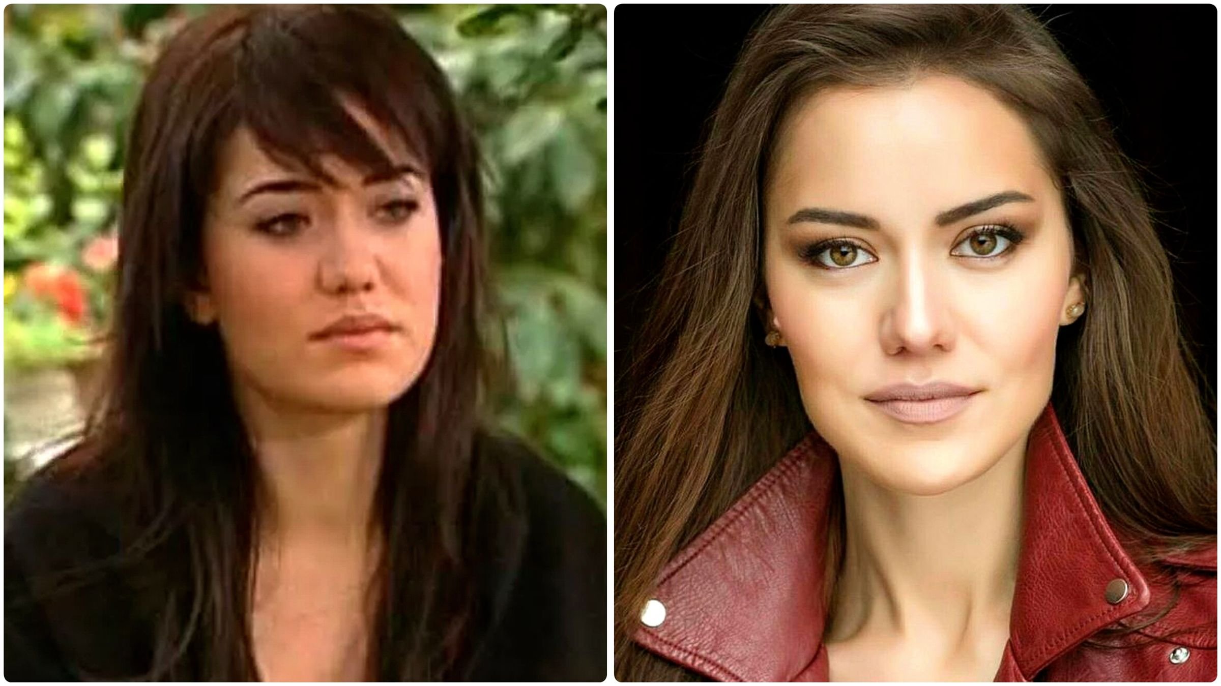 фахрие эвджен пластика. актриса фахрие эвджен пластика. фахрие эвджен до пластики. фахрие до пластики. фахрийе эвджен до пластики.