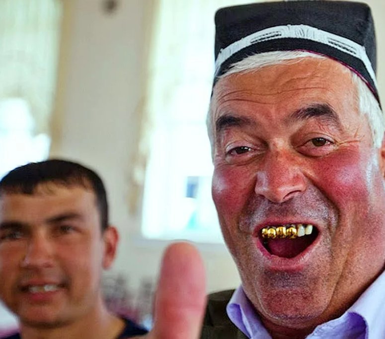 Таджик без уха. Лицо узбека. Улыбчивый таджик. Узбечка с золотыми зубами.