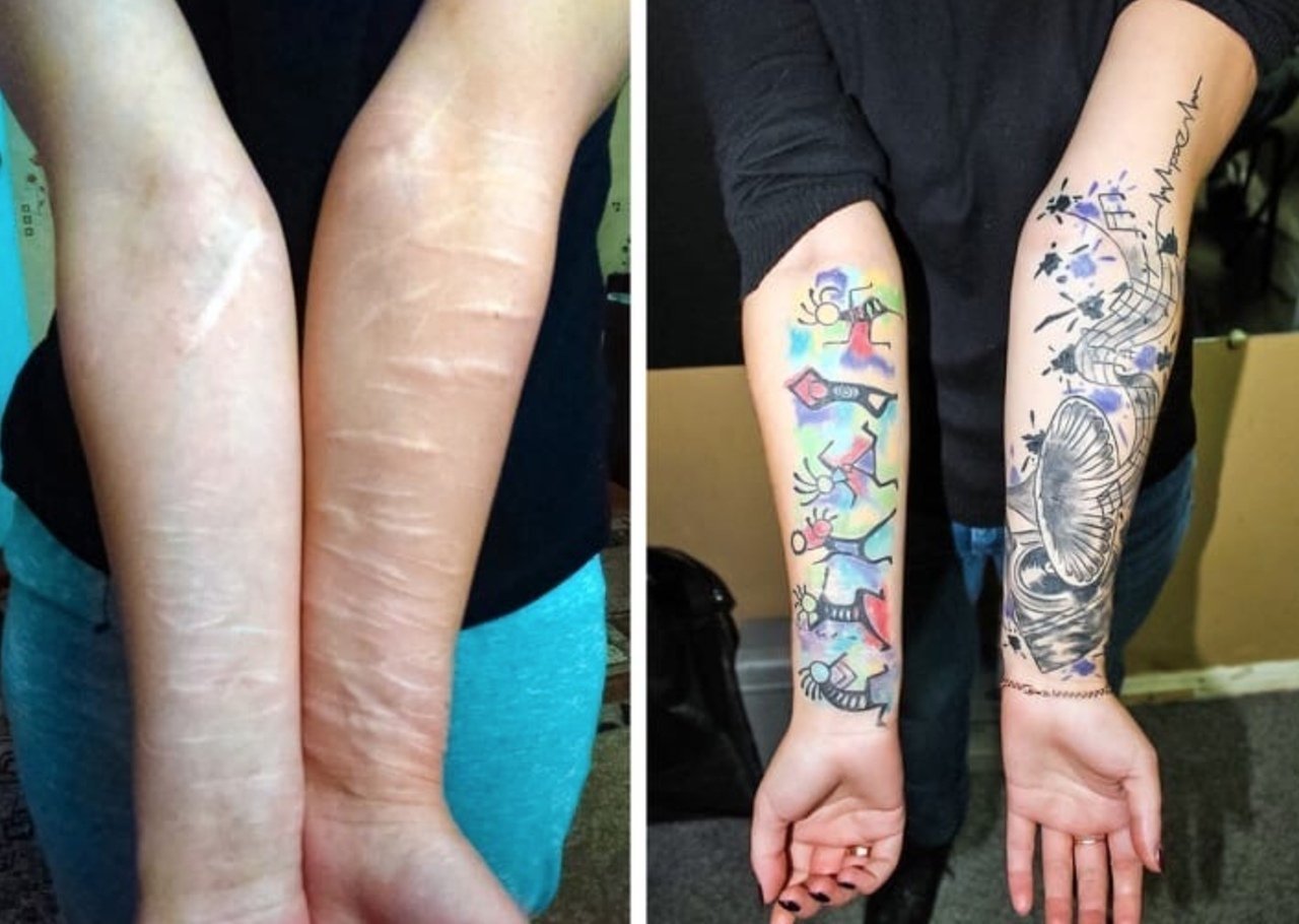 Перекрытие шрамов татуировкой на руке