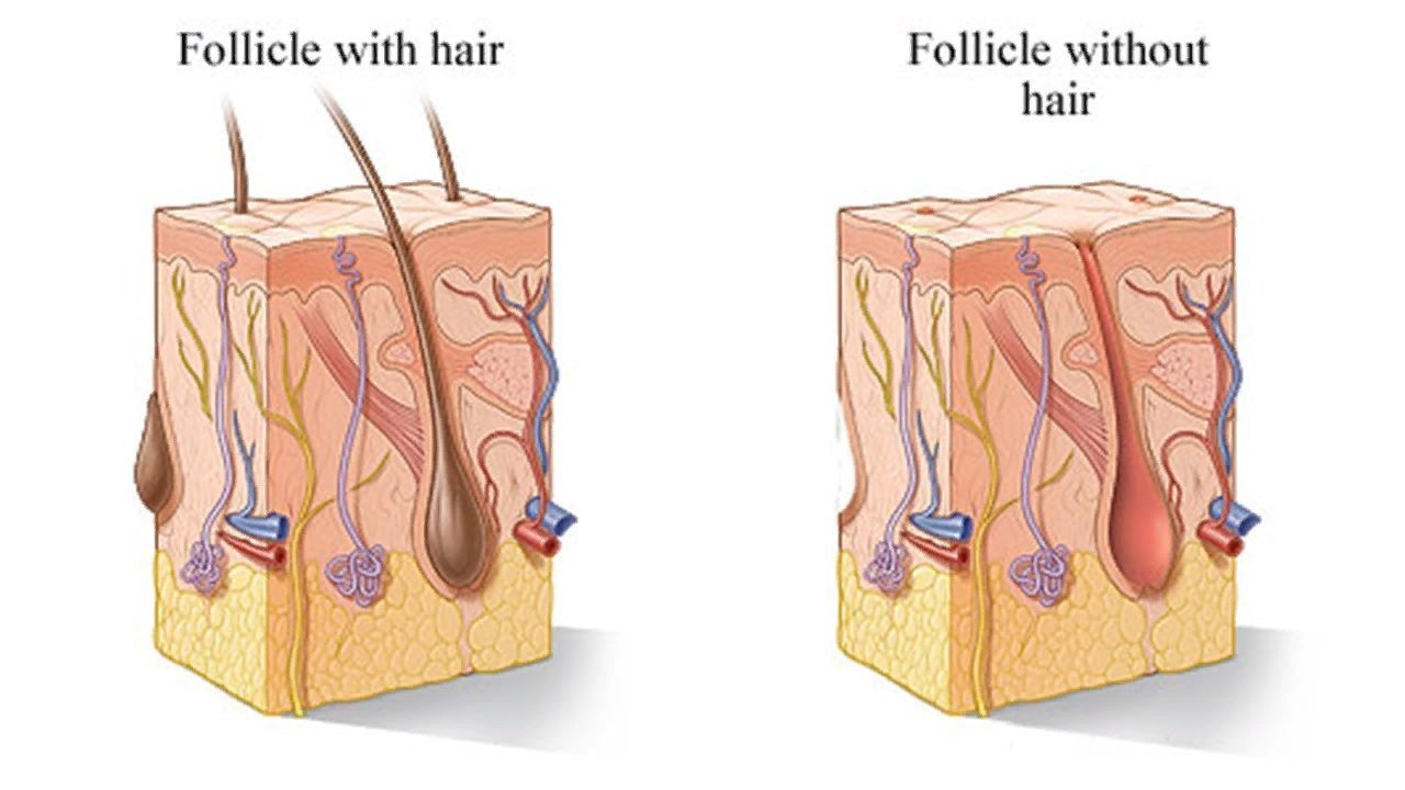 Чем открывается на поверхности кожи волосяной фолликул