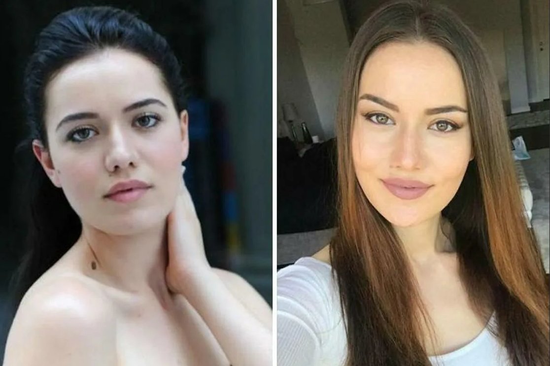 турецкая актриса неслихан атагюль. фахрие эвджен. фахрие эвджен до пластики. фахрие эвджен. актриса бирдже акалай до пластики.