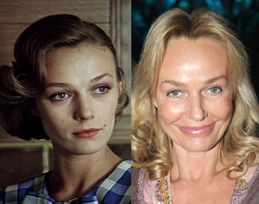 Российские актрисы до и после пластики фото