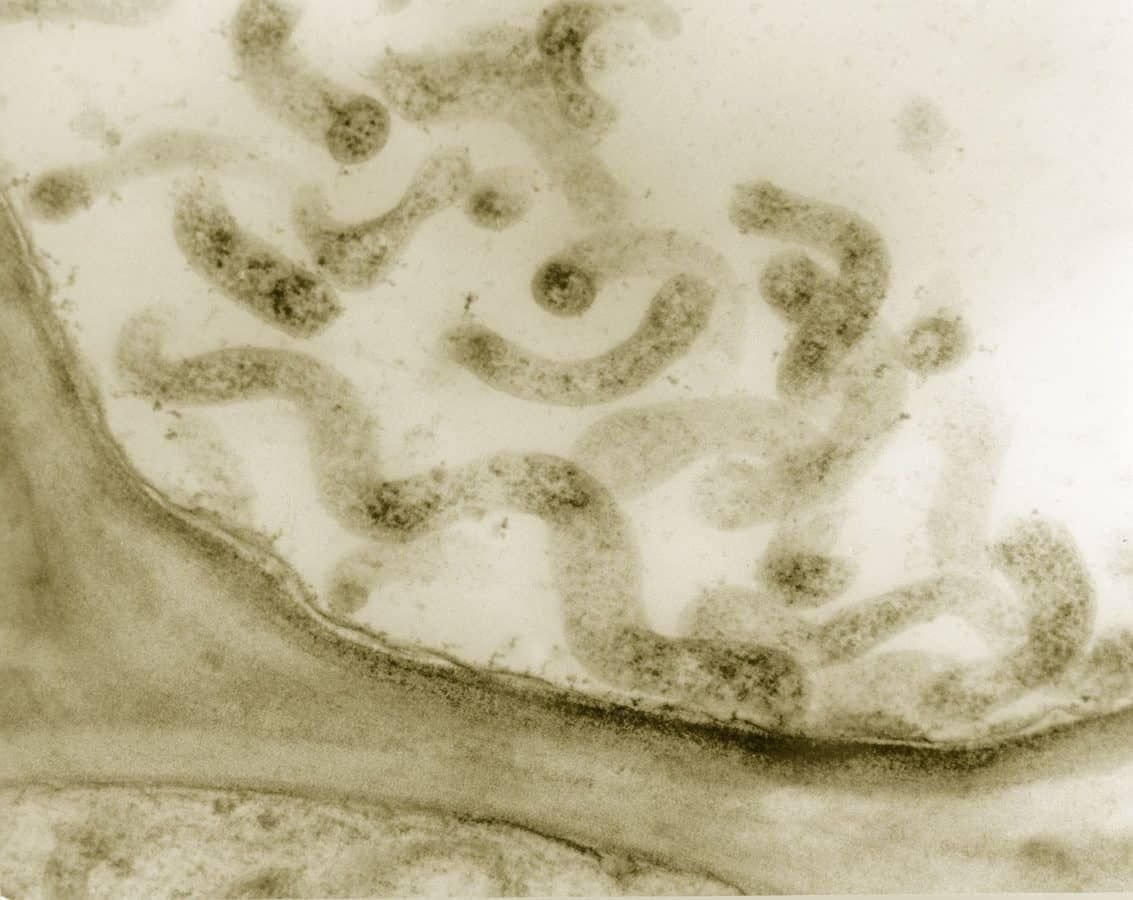 Мельчайшая форма жизнь. Spiroplasma melliferum. Спироплазма бактерия. Тенерикуты это бактерии. Спироплазма под микроскопом.