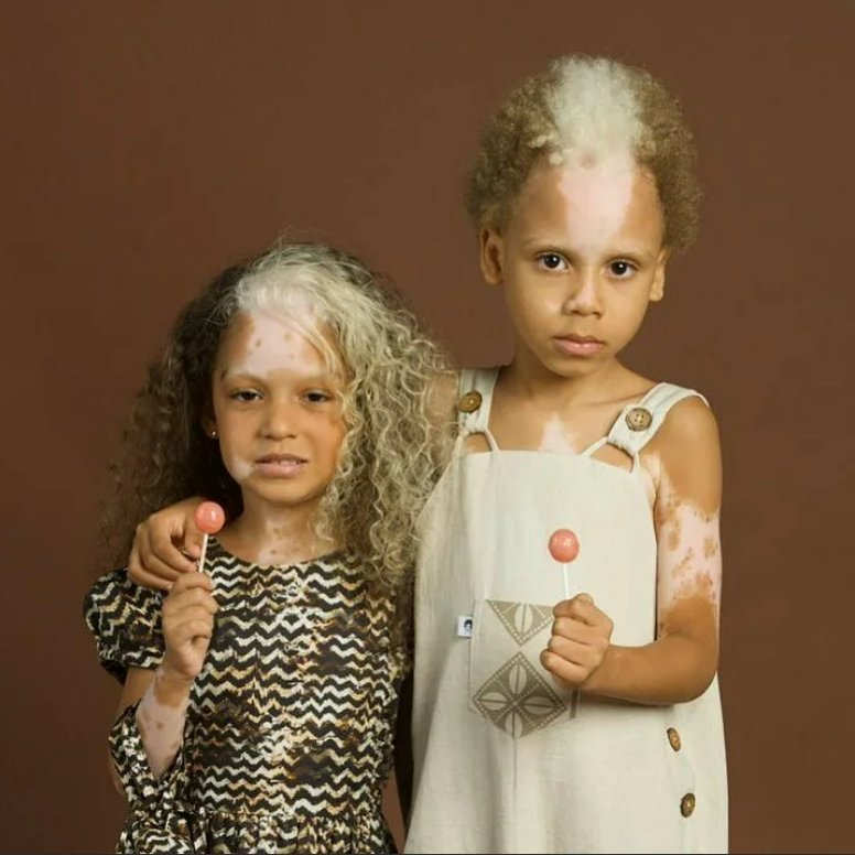 Куклы 20 века. Разные дети. Олли трезис мальчик пиноккио. Истории уникальных детей. Самая маленькая девочка.