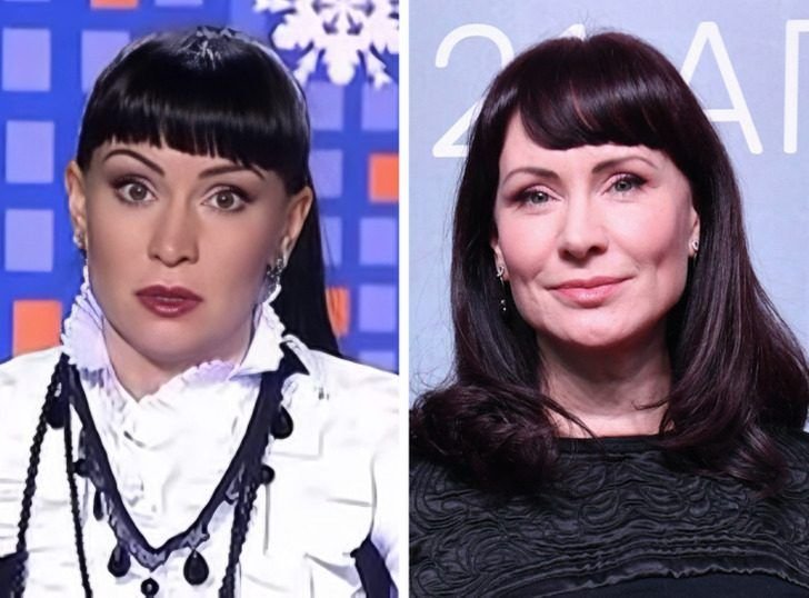 Нонна гришаева пластика фото до и после