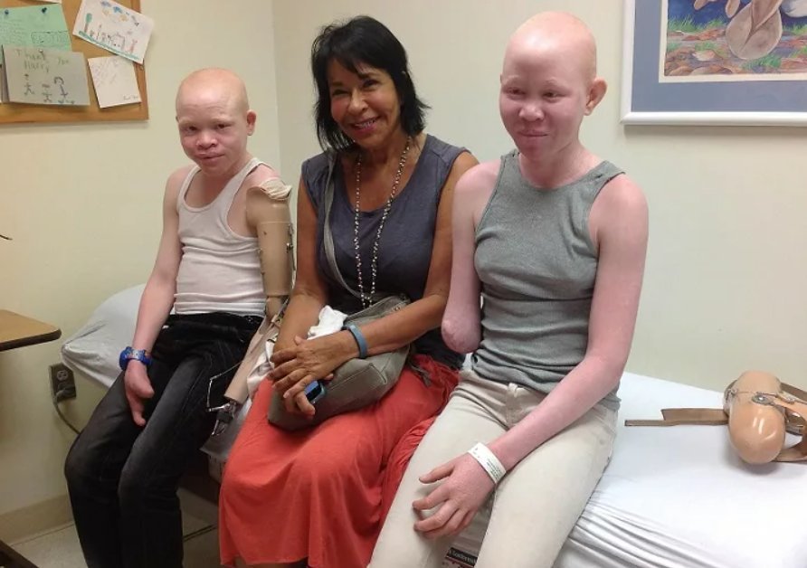 где едят альбиносов