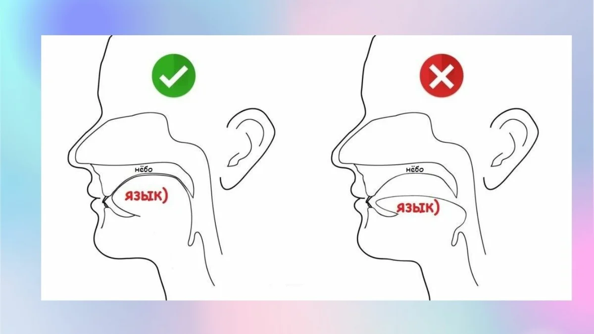 Как держать язык во рту. Правильно расположение языка. Нормальное положение языка во рту. Правильное положение языка.