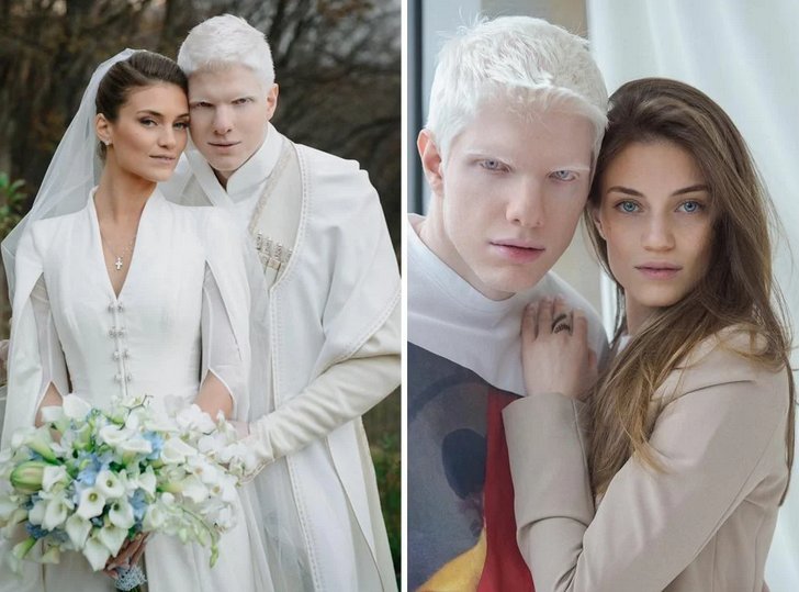 братья иванишвили. настя жидкова альбинос. тотальный альбинизм. жена альбинос. жена альбинос.