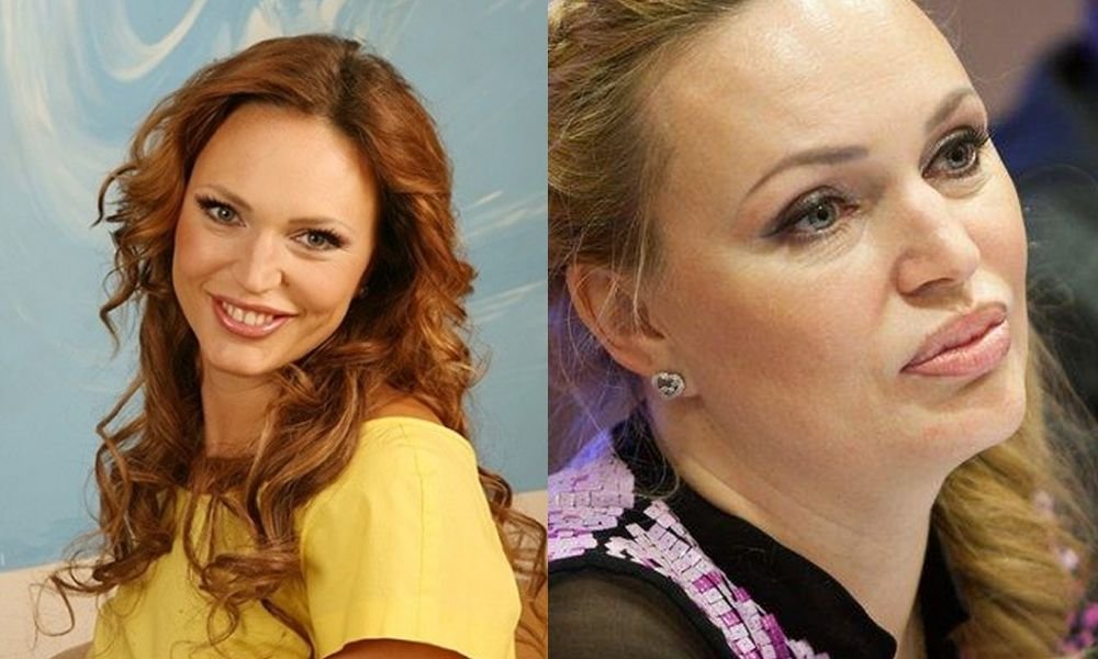 Алла довлатова фото до пластики