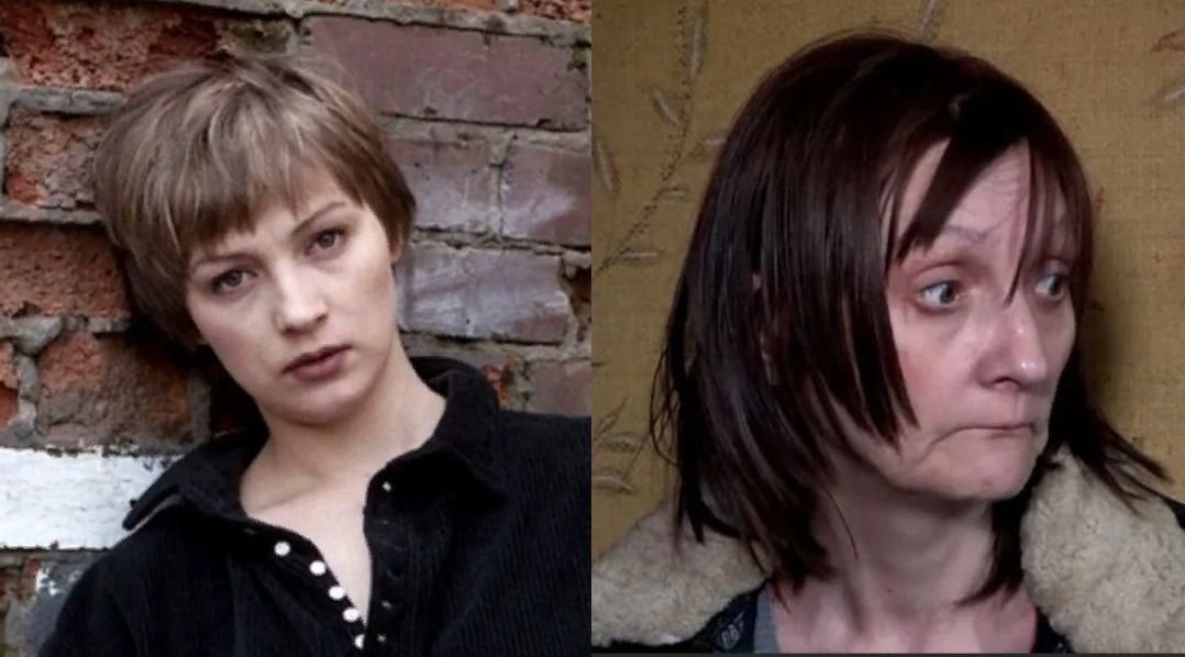 Ксения Качалина фото до и после алкоголизма