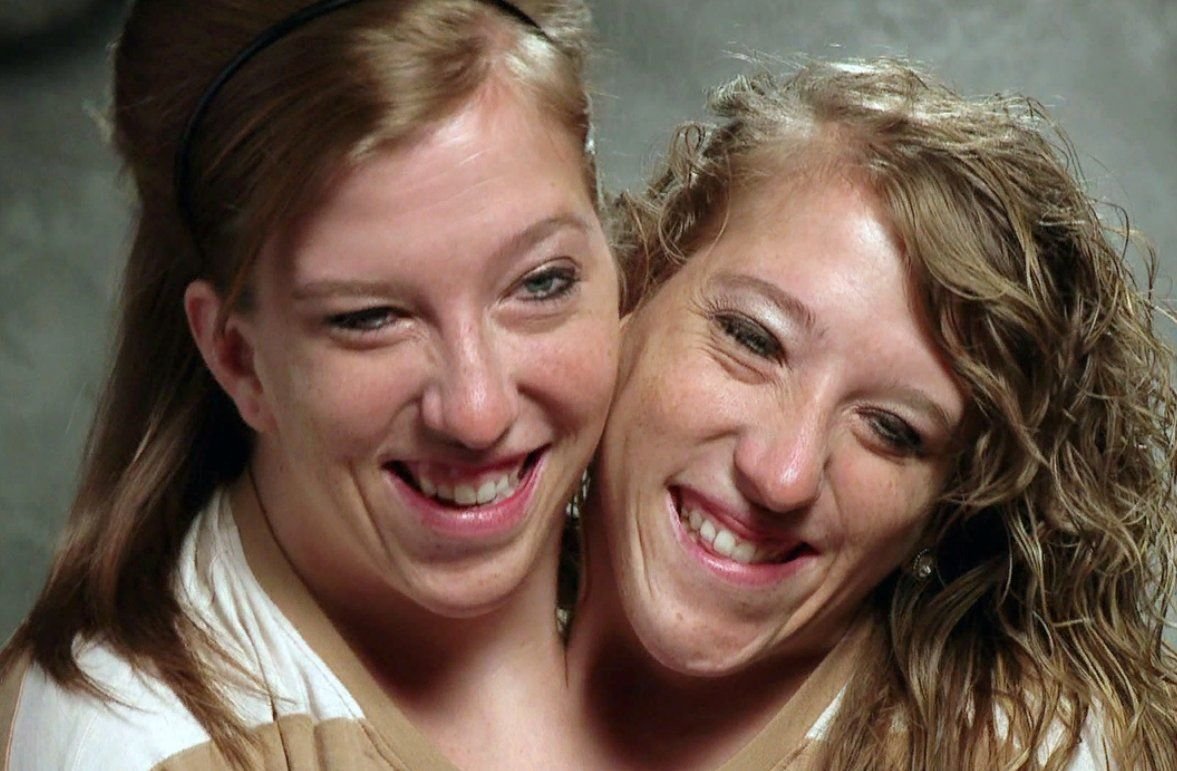 Свадьба сиамских близнецов сестер бритт и эбби. Сёстры Эбигейл и Бриттани Хенсел. Эбигейл и Бриттани Хенсел 2020.