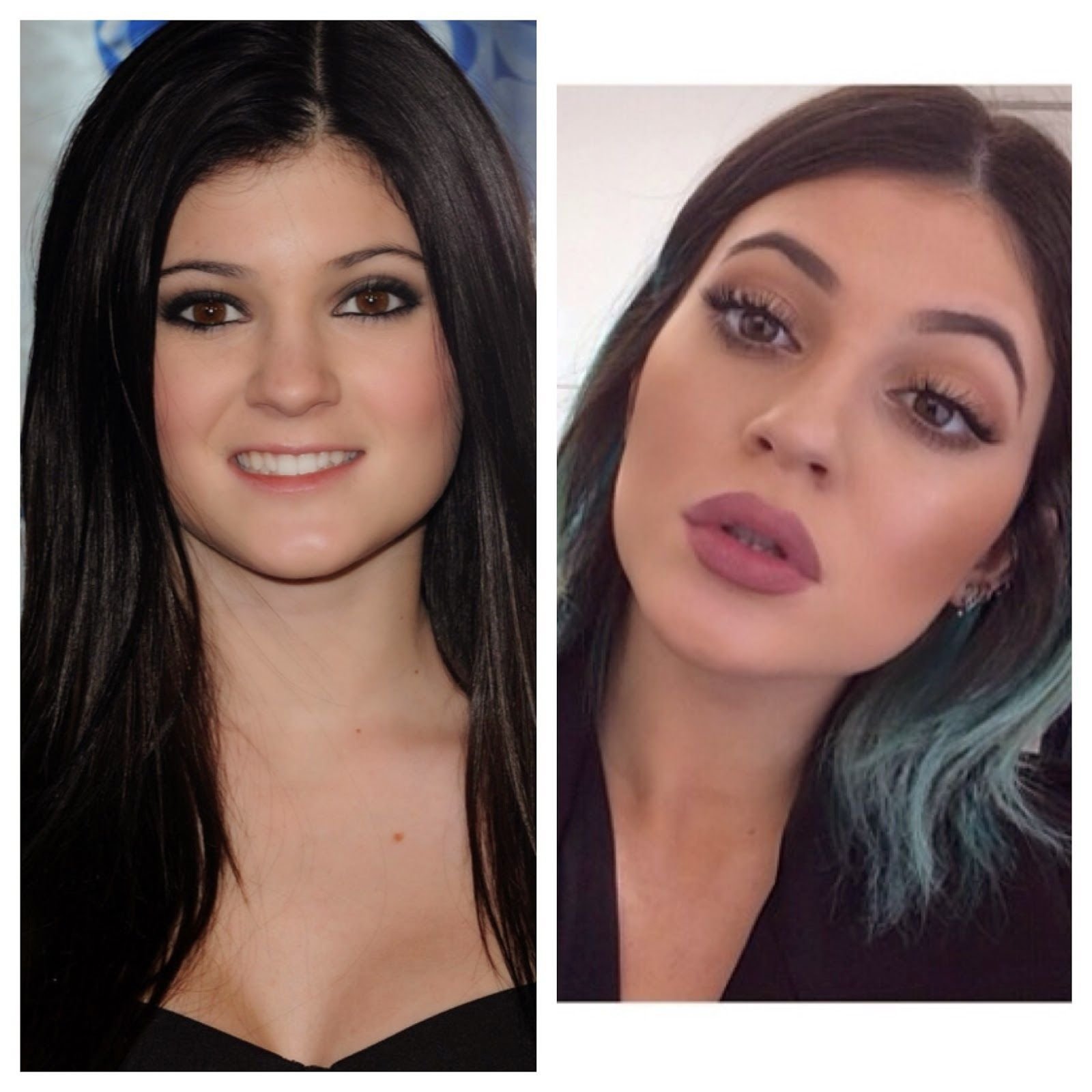 Красивые накаченные губы до и после фото