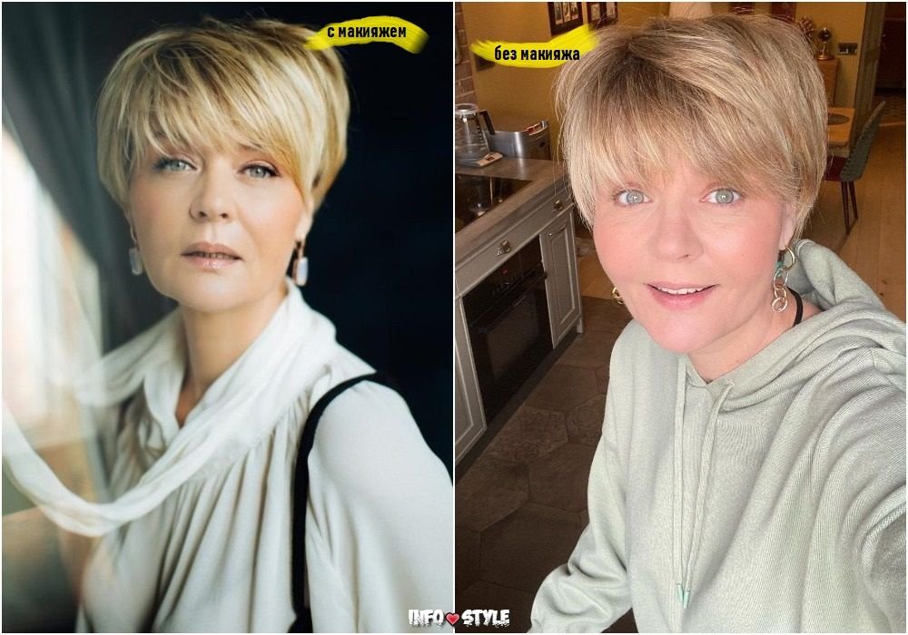 Юлия меньшова пластика лица фото до и после