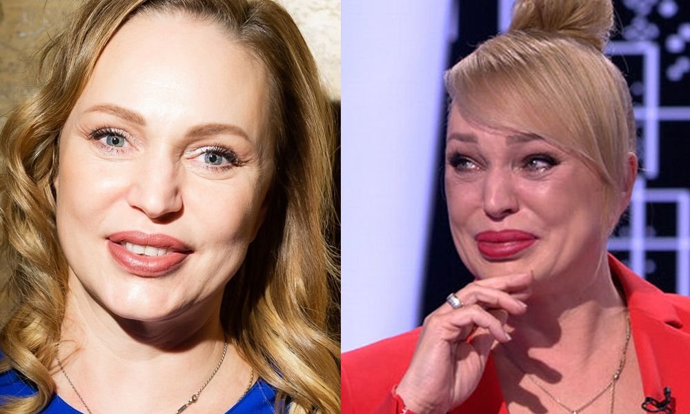Алла довлатова фото до пластики