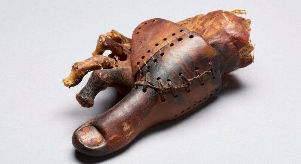 первые протезы. первые протезы. протез руки амбруаз паре. протез пальца древний египет. механический протез кулибина.