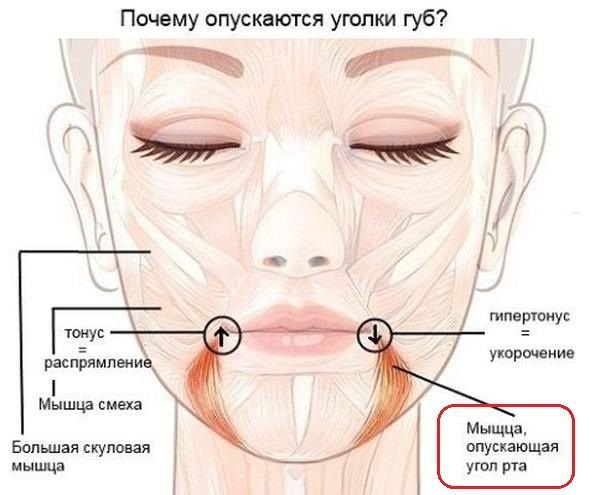 Поднять уголки губ тейпами схема
