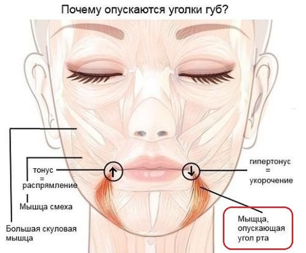 Как поднять уголки губ тейпами схема