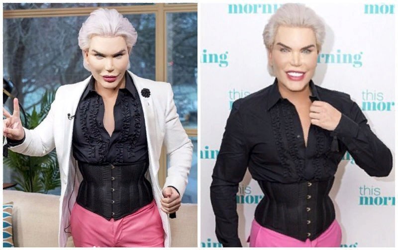 мужчины удаляют ребра. мужчины удаляют ребра. мужчины удаляют ребра. родриго алвес. мужчина который удалил себе ребра.