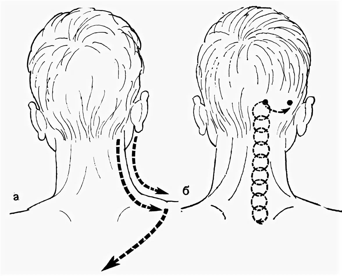 Строй затылок в затылок. Схема массаж шейно-воротниковой зоны. Техника массажа шейно-воротниковой зоны. Шейно-воротниковая зона массаж схема массажа. Массажные линии шеи сзади схема.