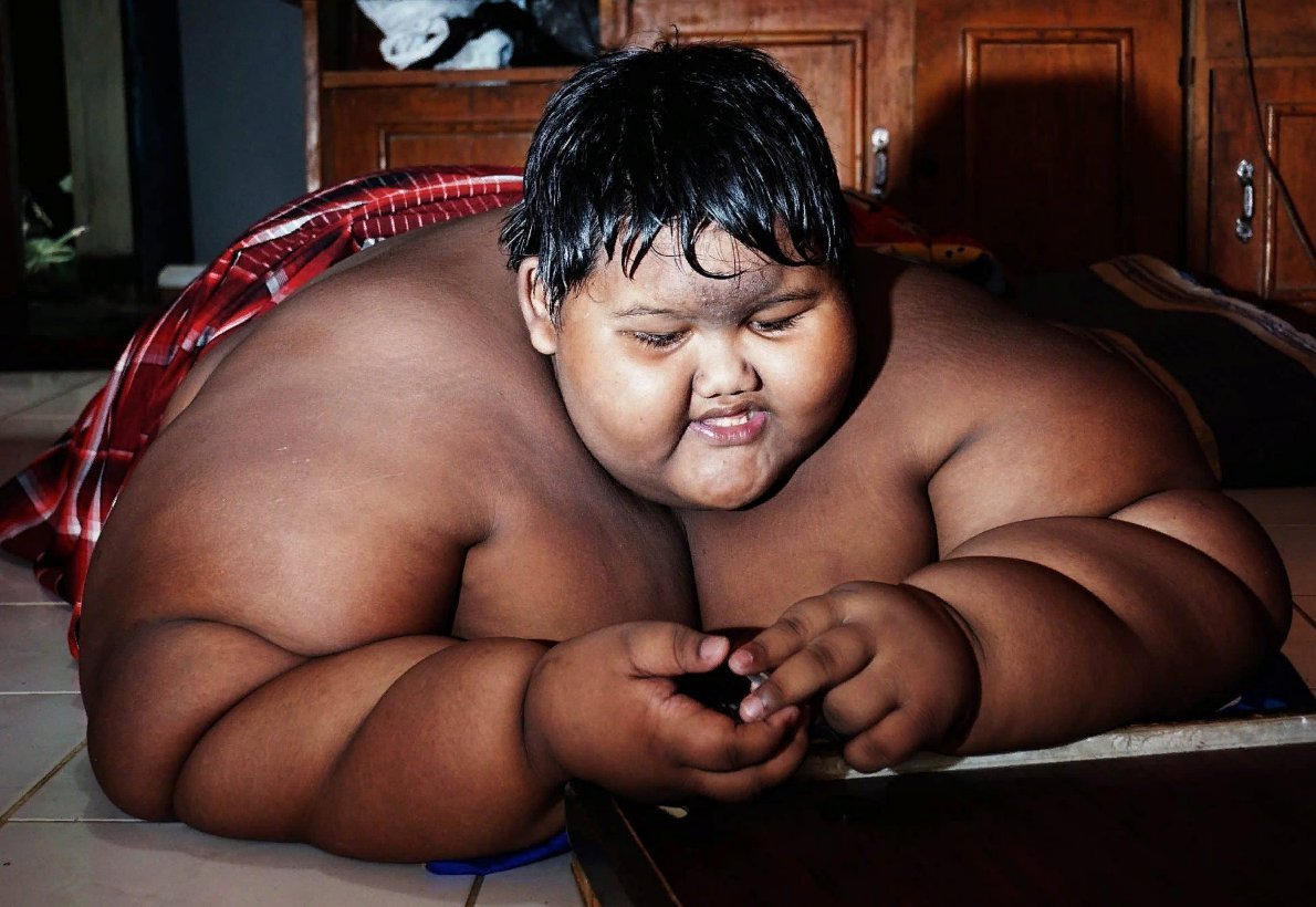 Ожирение 11 лет. Арья Пермана самый толстый человек в мире. Самый толстый мальчик Арья Пермана.