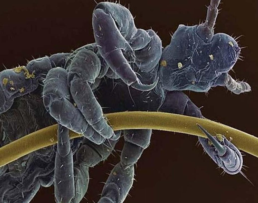 Бактерии фотографии под микроскопом