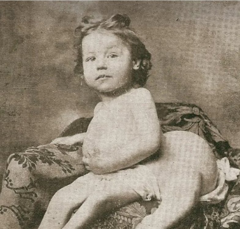 белла отеро. бланш дюма фото трехногая куртизанка. бланш дюма фото трехногая куртизанка. жозефина миртл бикнелл. бланш дюма трехногая женщина.