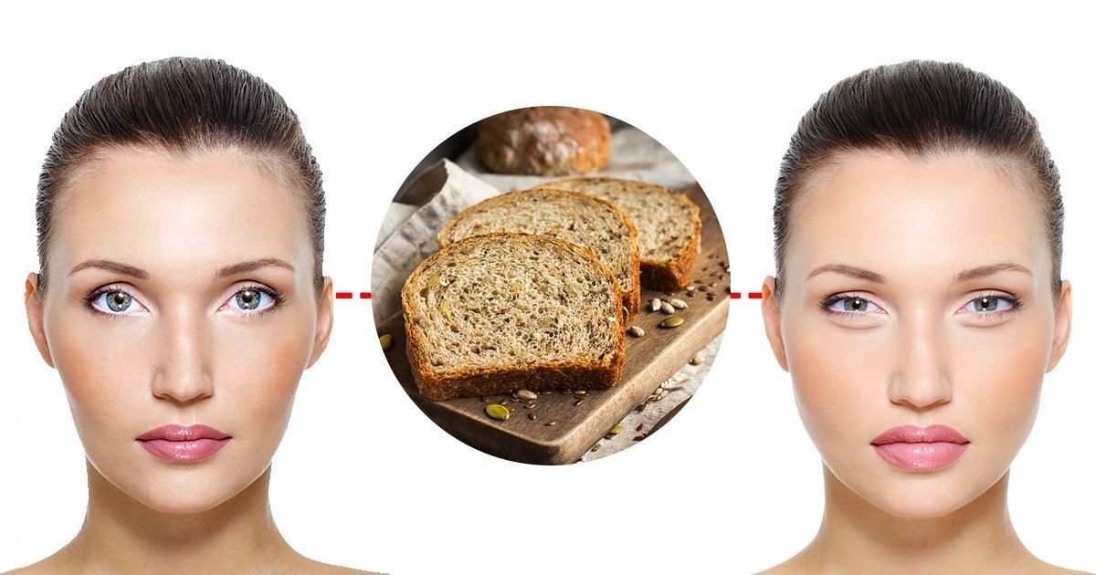 отек лица диета