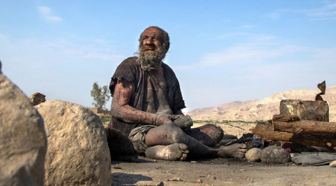 Самый грязный человек в мире аму хаджи. Аму хаджи человек который не мылся. Как называется грязный человек. Аму хаджи человек который не мылся. Аму хаджи человек который не мылся 60 лет.