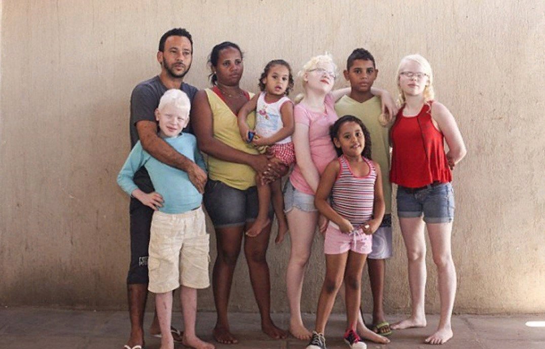 Unusual families. Семья Пуллан. Необычные дети. Необычная семья. Семья альбиносов.