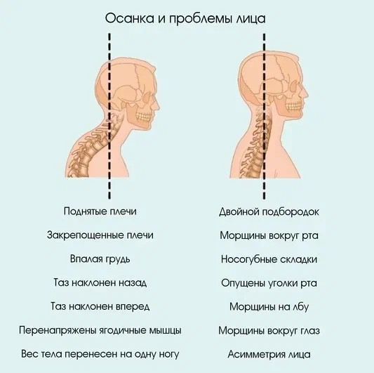 Осанка и лицо до и после