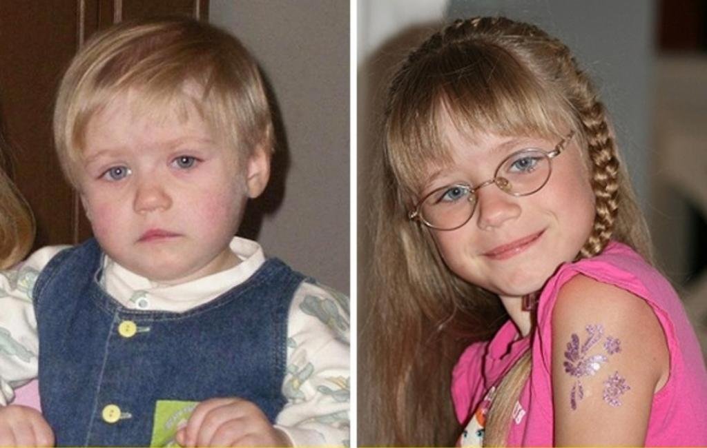 удочеренные дети до и после. приемные дети до и после фото. удочеренные дети до и после. детки до и после усыновления. дети из детдома фото до и после.