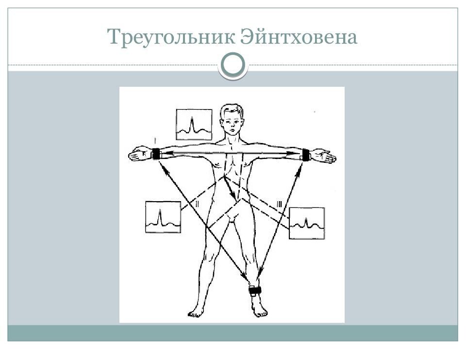 Треугольник эйнтховена схема