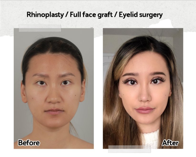 Тест под корейские стандарты красоты. Керина Ванг Возраст. Jackson Wang before and after Surgery.