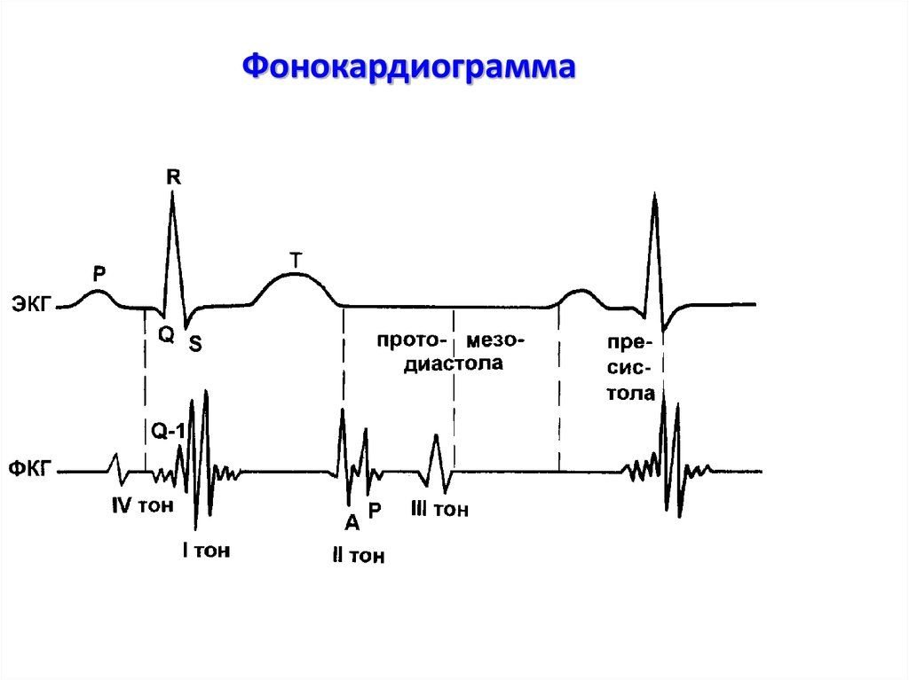 Схема экг в норме
