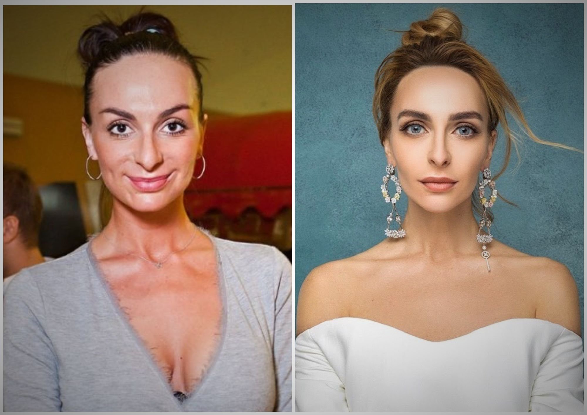 екатерина варнава фото до и после операции