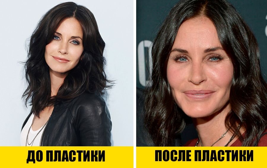 Кортни кокс до и после пластики Не стыдно? 12 звезд, которые сделали пластику и не стесняются этого Учебник крас