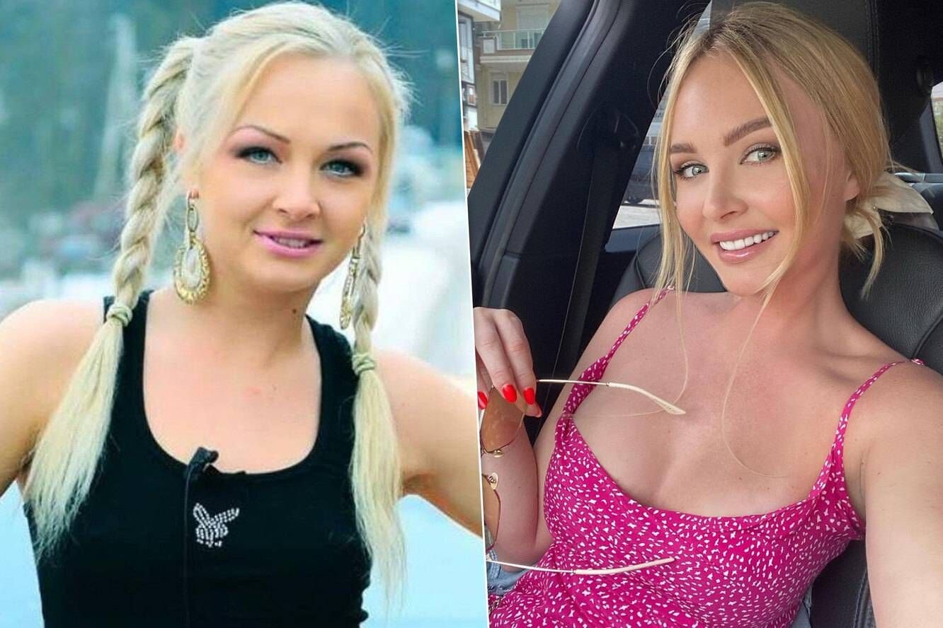 пынзарь до и после пластики. дарья пынзарь до операции. дарья пынзарь пластика. даша пынзарь пластика. даша пынзарь после пластики.