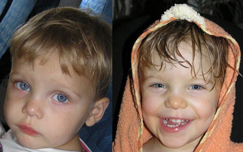 детдомовские дети до и после. до и после детдома. дети после усыновления до и после. удочеренные дети до и после. усыновленный ребенок до и после.