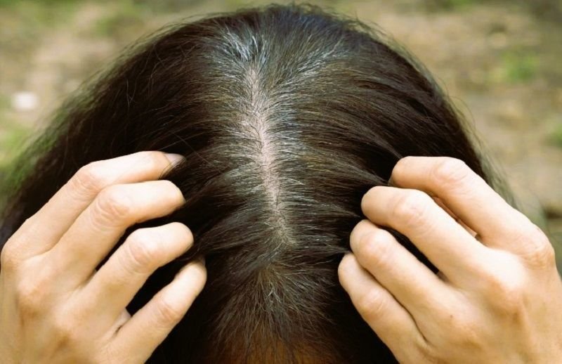 Как семечки влияют на волосы
