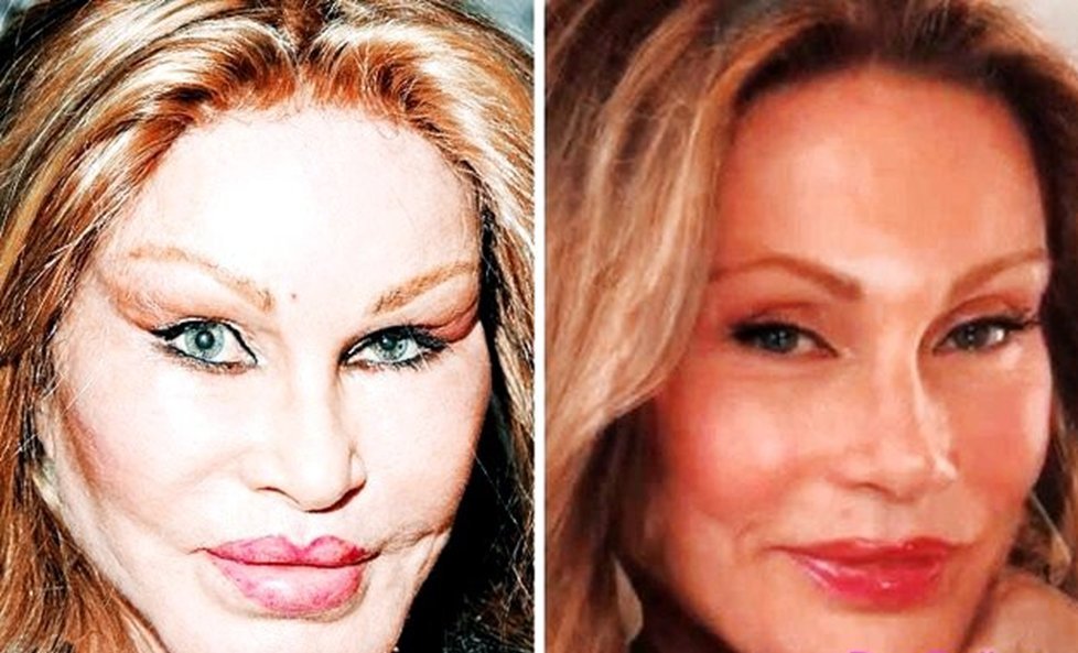 джослин вильденштейн 2018. джоселин вильденштейн в 1985. донателла версаче до пластических операций. джослин вильденштейн 2023. коды пластических операций.