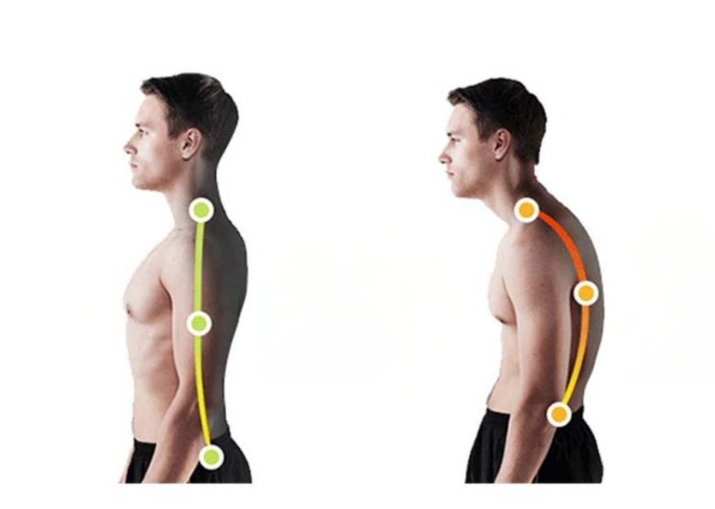 Спина плохая. Сутулость вид сбоку. Прямая осанка сбоку у мужчин. Круглая спина. Сутулая осанка.