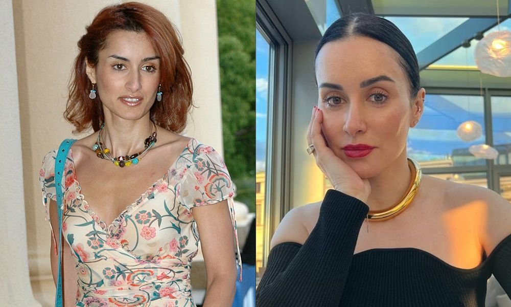 Пластические операции Тины Канделаки, фото в молодости и сейчас