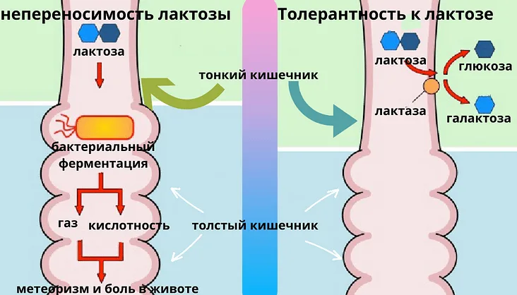 Непереносимость лактозы карта